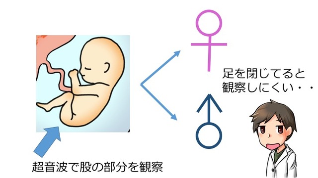 赤ちゃんの性別は簡単に教えてはいけない 性別判定方法と時期 Eparkくすりの窓口コラム ヘルスケア情報