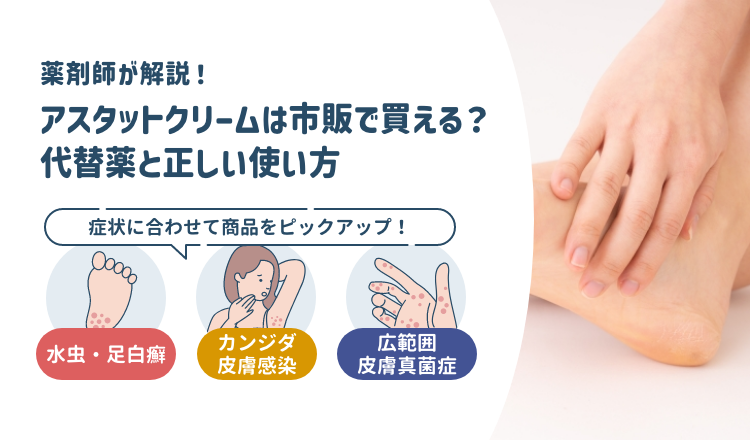 アスタットクリームは市販で買える？同成分・同等効果の代替薬と正しい使い方【薬剤師解説】