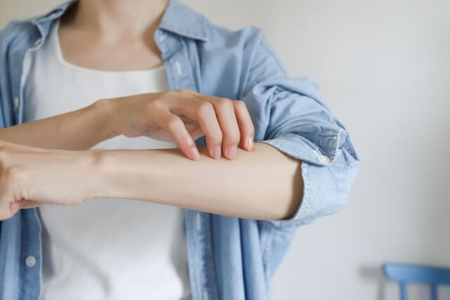 ダニ刺されに効く市販薬12選！かゆみが止まらないつらいダニ刺されに【最強はどれ？薬剤師解説】