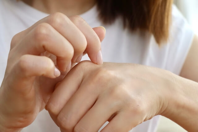 フルコートfってすごい？使い方と注意点を解説｜皮膚用市販薬おすすめも【薬剤師解説】