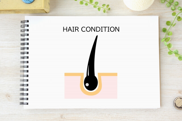 円形脱毛症に効く薬とは？使われる市販薬の選び方とおすすめ商品を徹底解説【薬剤師執筆】