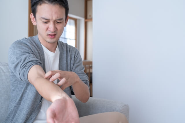虫刺されが1ヶ月治らないのはなぜ？原因と対処法を徹底解説！おすすめ市販薬と選び方も【薬剤師解説】