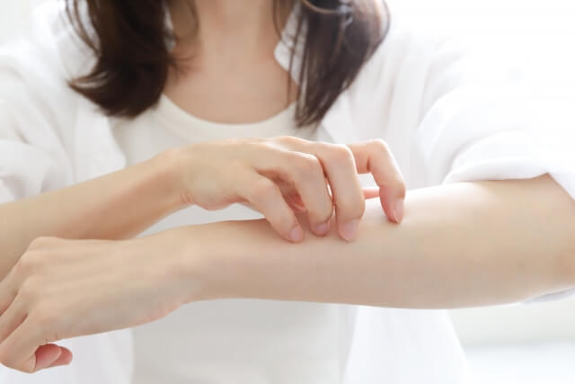 貨幣状湿疹におすすめの市販薬12選を紹介！｜かゆみ・炎症を鎮める軟膏・クリームでケア【薬剤師解説】