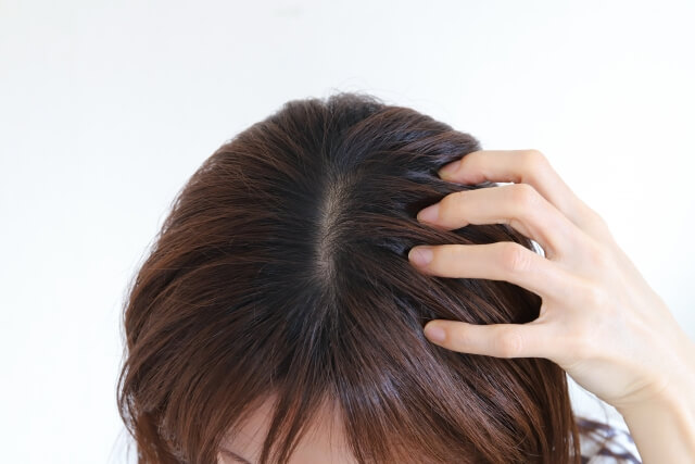 頭皮ニキビの市販薬で最強はどれ？市販薬おすすめ12選を紹介！｜炎症・かゆみ・膿を徹底ケア【薬剤師解説】