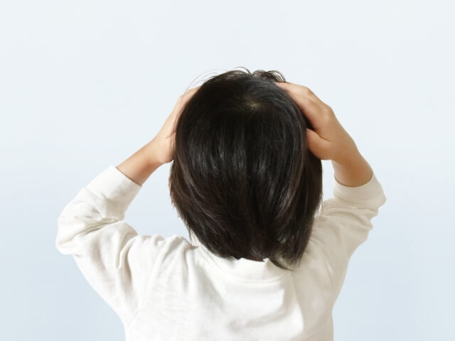 頭皮のできものを緩和できる市販薬の選び方・ポイント