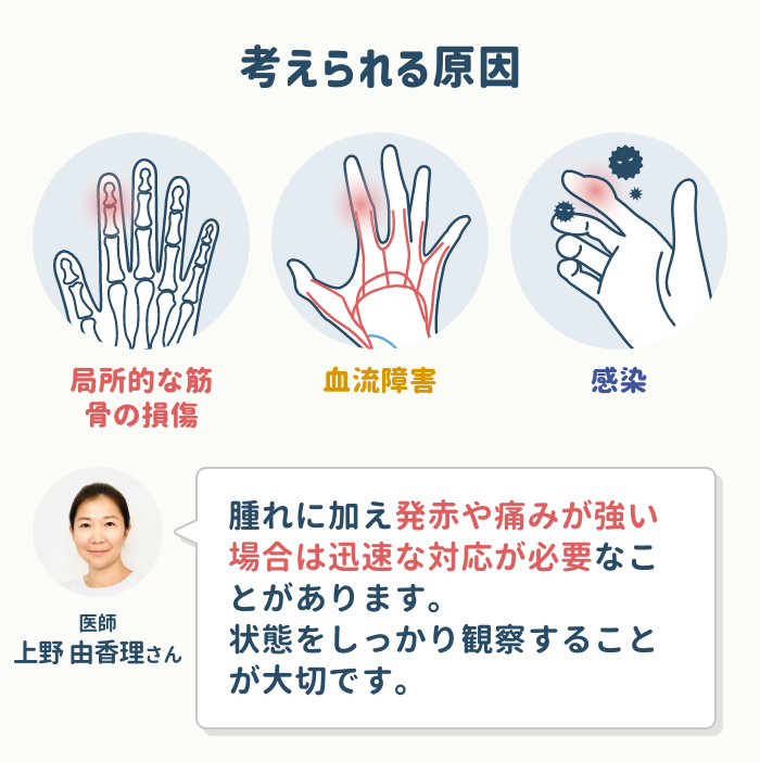 1本だけ指が腫れる場合に考えられる原因は？