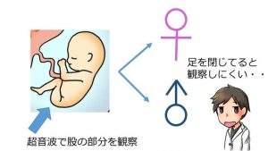 赤ちゃんの性別は簡単に教えてはいけない？性別判定方法と時期