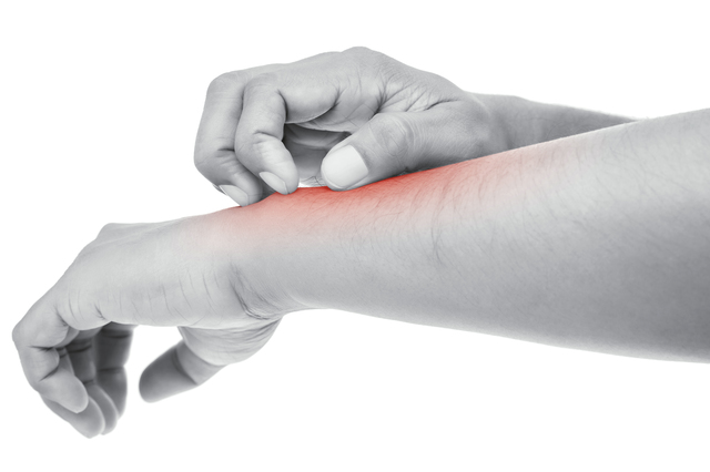 手がじゅくじゅくする 赤くなる 湿疹の原因ってどんなもの Eparkくすりの窓口コラム ヘルスケア情報 手がじゅくじゅくする 赤くなる 湿疹の原因ってどんなもの Eparkくすりの窓口コラム ヘルスケア情報