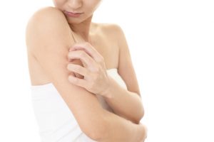 【皮膚科医が解説】虫別に刺されたときの対処法と虫刺されあとの治し方を解説