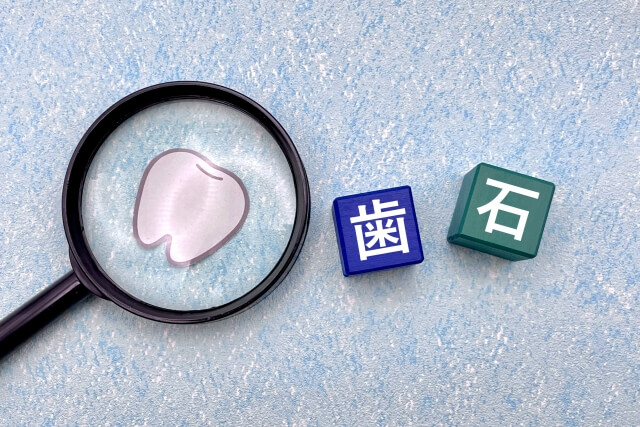 【医師が解説】歯石取りが痛い原因は？痛さを防ぐための市販薬も紹介
