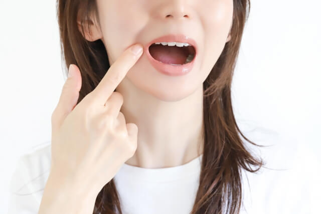 ヘルペス（口唇ヘルペス）に効く市販薬9選を紹介！｜症状に合わせた選び方や注意点も【薬剤師解説】