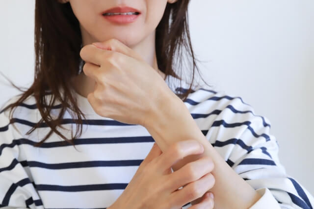 【症状別】かゆみにおすすめの市販薬の選び方