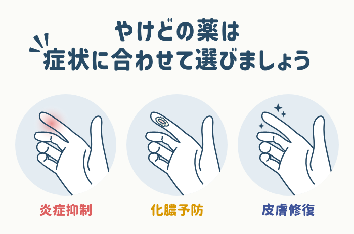 冷やしていないと痛い指はどうすればいい？やけどにおすすめの市販薬 6選も紹介【薬剤師が解説】 Eparkくすりの窓口コラム｜ヘルスケア情報 