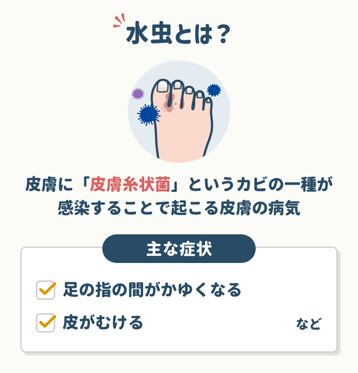 水虫とは?原因と症状の種類を解説
