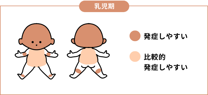 乳児期
