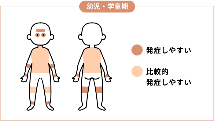 幼児・学童期