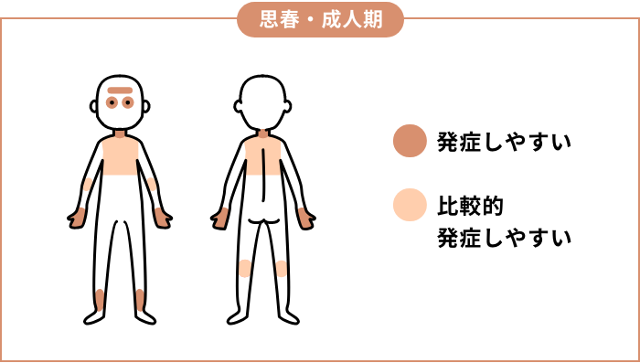 思春期・成人期