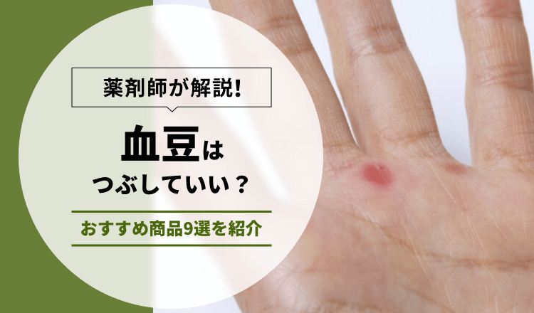 薬剤師が解説】血豆はつぶしていい？おすすめの商品 9選を紹介 – EPARKくすりの窓口コラム｜ヘルスケア情報