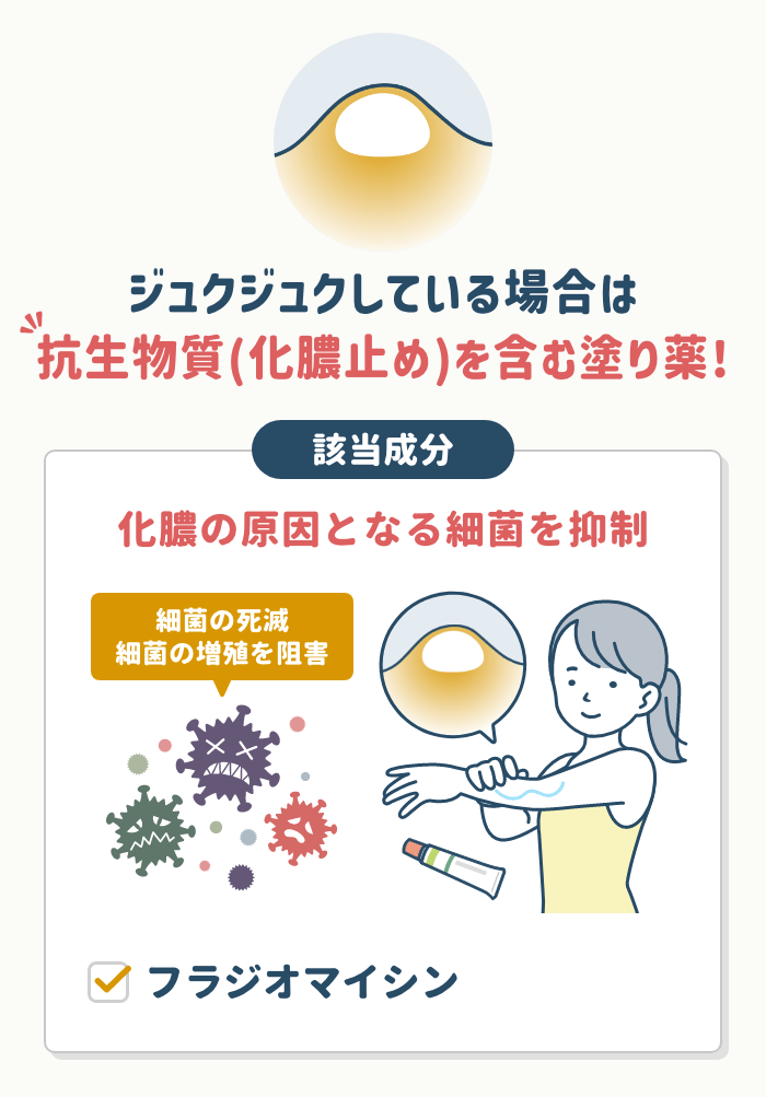 接触性皮膚炎におすすめの市販薬12選【皮膚科医選定】 – EPARKくすりの窓口コラム｜ヘルスケア情報