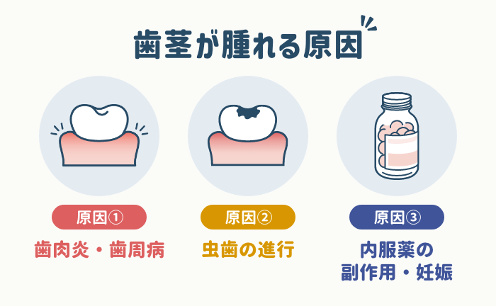 歯茎が腫れる原因は？