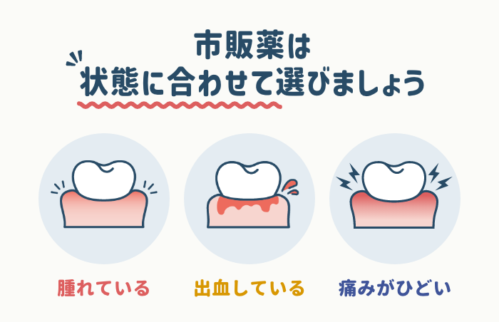 歯茎の腫れにおすすめの市販薬の選び方