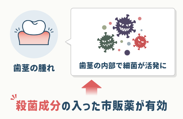 歯茎が腫れている場合は殺菌成分入りを選ぶ