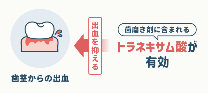 歯茎から出血している場合はトラネキサム酸を選ぶ