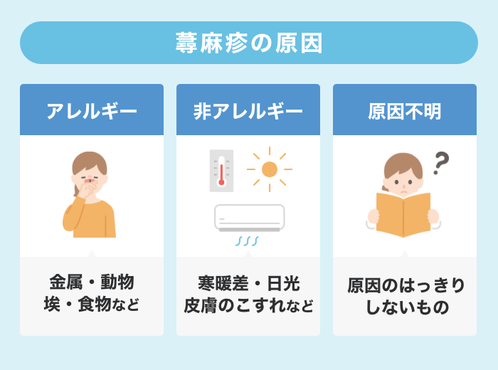 22年 皮膚科医監修 蕁麻疹に効果がある市販薬はある その成分 効果を解説 Eparkくすりの窓口コラム ヘルスケア情報