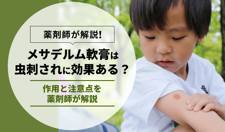 【メサデルム軟膏は虫刺されに効果ある？】作用と注意点を薬剤師が解説