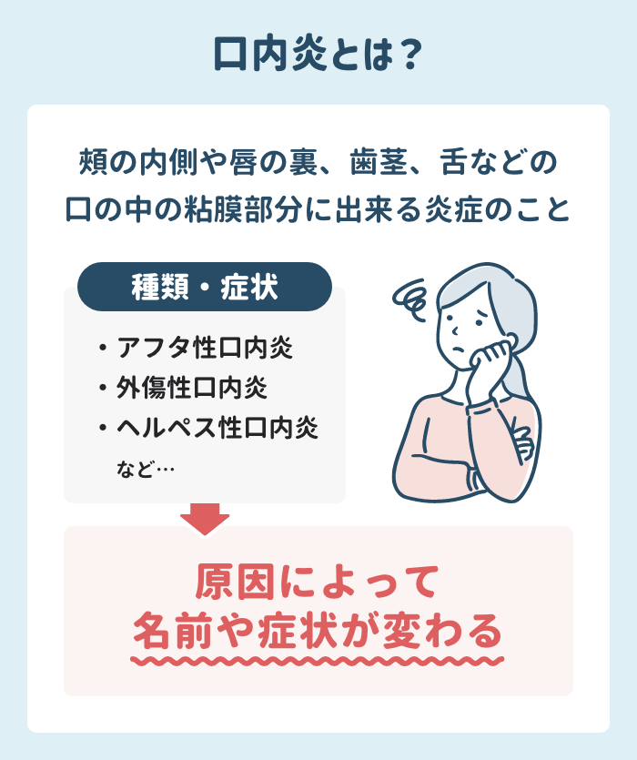 そもそも口内炎とは?