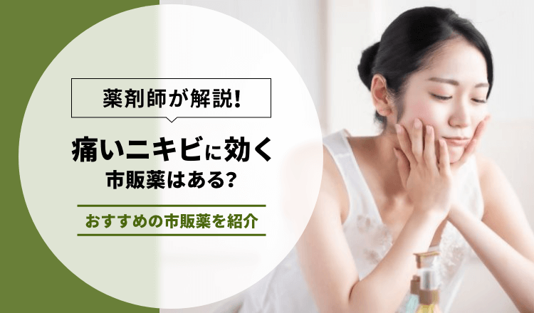 【薬剤師が解説】痛いニキビに効く市販薬はある？おすすめの市販薬を紹介