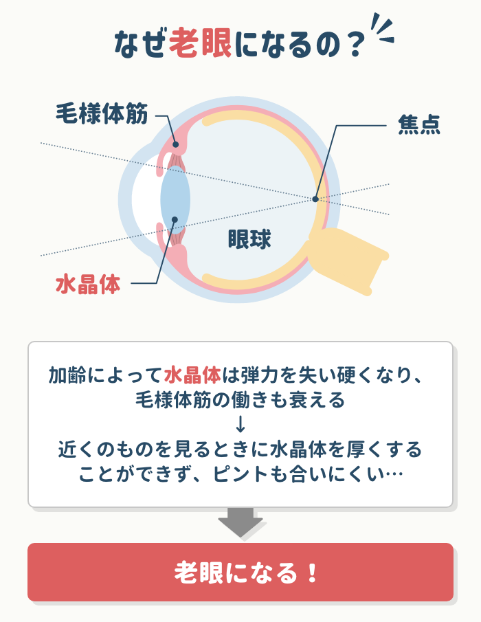 老眼のメカニズム