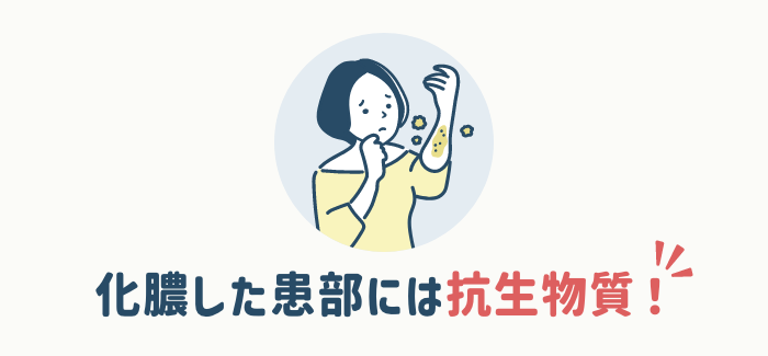 【化膿した患部を改善したい方】は抗生物質配合の塗り薬