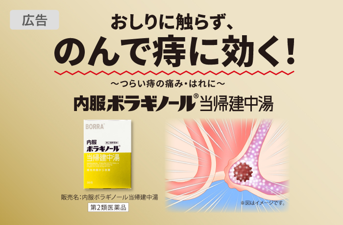 いぼ痔におすすめの市販薬】薬剤師が厳選した6選 – EPARKくすりの窓口コラム｜ヘルスケア情報